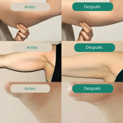 DRENAJE LINFÁTICO